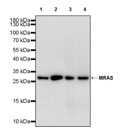 MRAS Recombinant Rabbit mAb (S-4293-71)