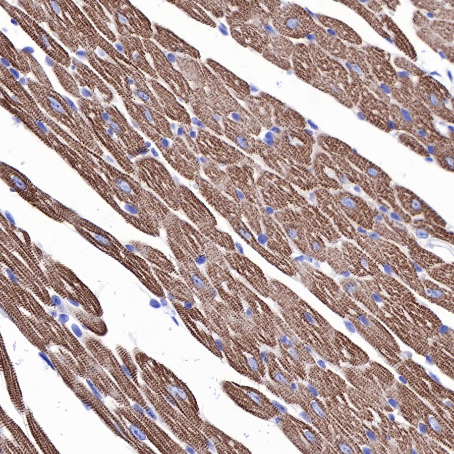alpha-actinin-2 Recombinant Rabbit mAb (SDT-032-79)