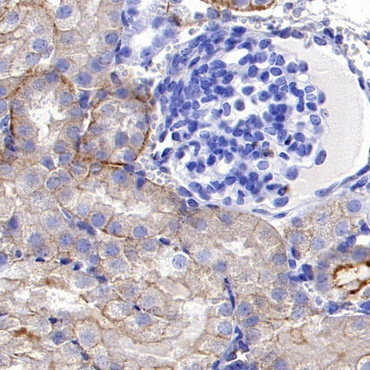 TRPV4 Recombinant Rabbit mAb (S-1746-65)