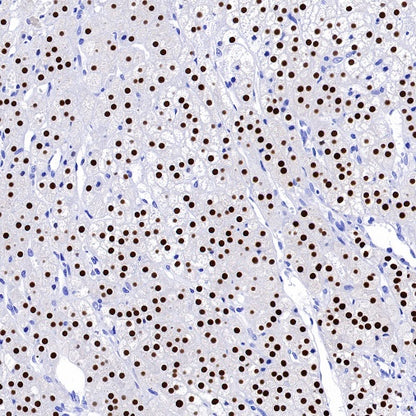 S-RMab®Steroidogenic Factor 1/SF-1 Recombinant Rabbit mAb (SDT-1666-11)