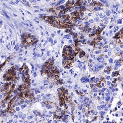 Nectin-4 Recombinant Rabbit mAb (SDT-277-229)