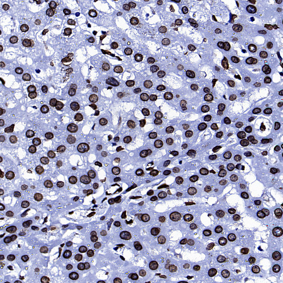 Lamin A/C Recombinant Rabbit mAb (S-5671)