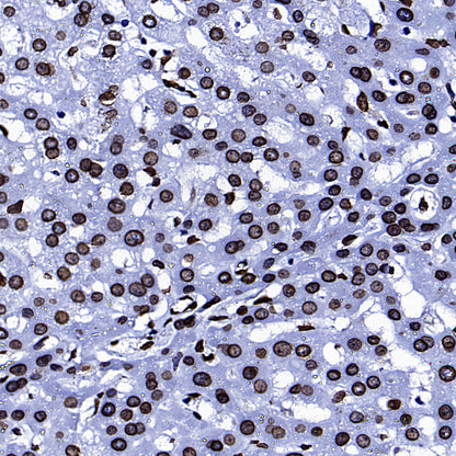 Lamin A/C Recombinant Rabbit mAb (S-5671)