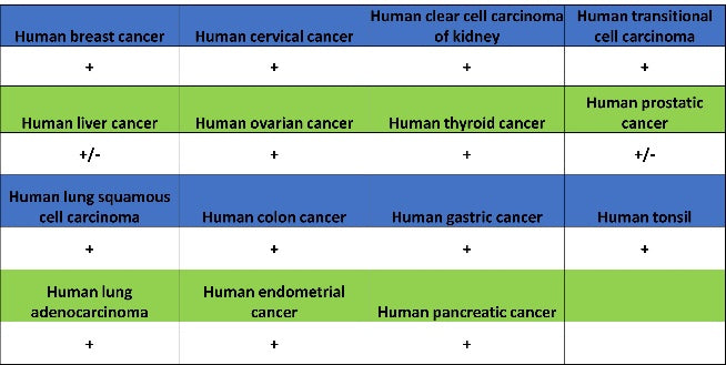 FTH1 Recombinant Rabbit mAb (S-1372-136)