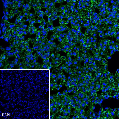 Aquaporin 5/AQP5 Recombinant Rabbit mAb (S-1622-5)