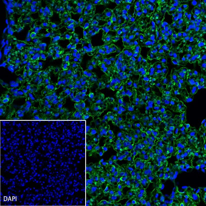 Aquaporin 5/AQP5 Recombinant Rabbit mAb (S-1622-5)