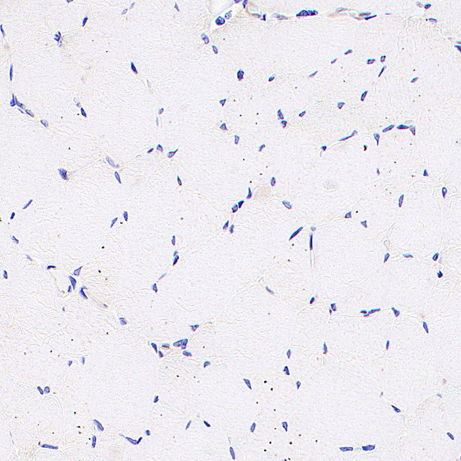 IFIT2 Recombinant Rabbit mAb (S-6029)