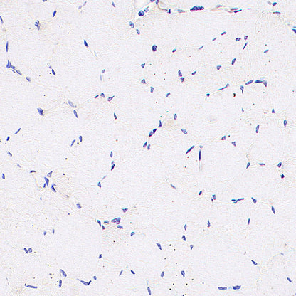 IFIT2 Recombinant Rabbit mAb (S-6029)