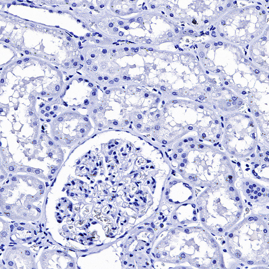 TSH Receptor/TSH-R Recombinant Rabbit mAb (S-5699)