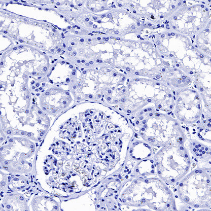 TSH Receptor/TSH-R Recombinant Rabbit mAb (S-5699)