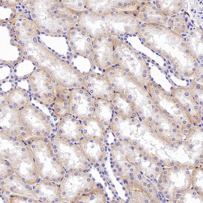 SLC30A1/ZnT1 Rabbit Polyclonal Antibody