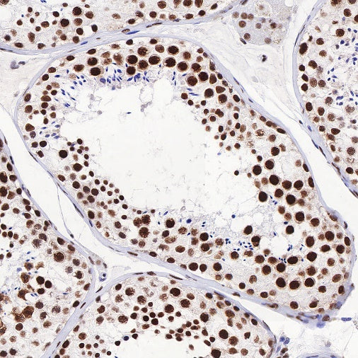 TDP43 Recombinant Rabbit mAb (S-R354)