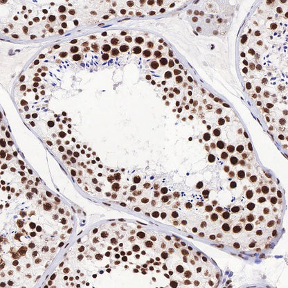TDP43 Recombinant Rabbit mAb (S-R354)