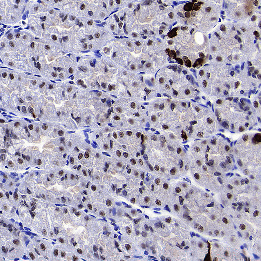 RBM10 Recombinant Rabbit mAb (S-4370-47)