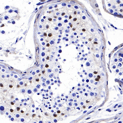 FoxO3a Recombinant Rabbit mAb (S-465-41)