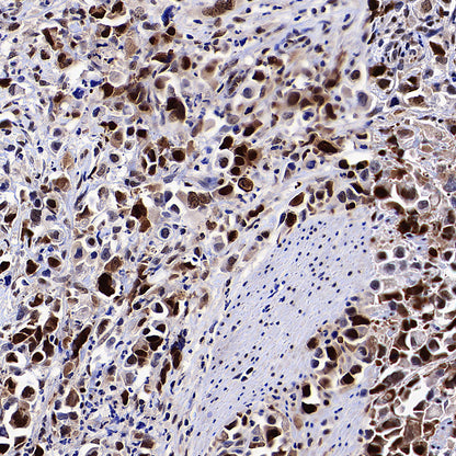 PCNA Recombinant Mouse mAb (S-5477)