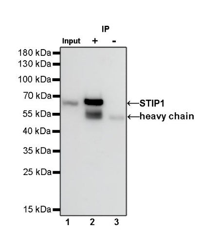 STIP1 Recombinant Rabbit mAb (S-680-39)