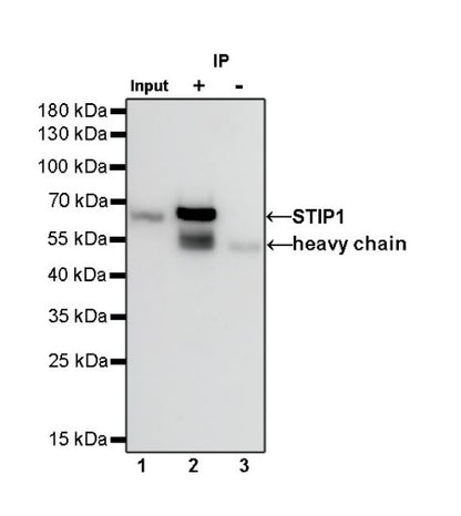 STIP1 Recombinant Rabbit mAb (S-680-39)