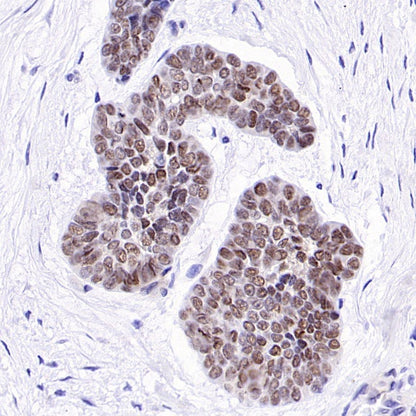 NUT Recombinant Rabbit mAb, PBS Only (SDT-3062)