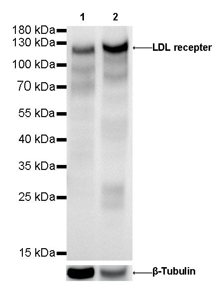 LDL receptor Recombinant Rabbit  mAb (SDT-057-57)