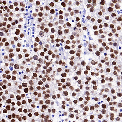 SALL4 Recombinant Rabbit mAb (SDT-1484-1)