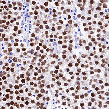 SALL4 Recombinant Rabbit mAb (SDT-1484-1)