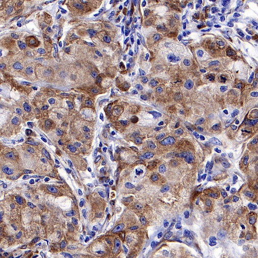 cGAS Recombinant Rabbit mAb (S-708-15)