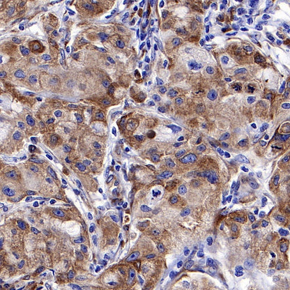 cGAS Recombinant Rabbit mAb (S-708-15)