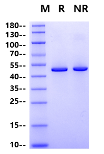 IDH1 His Tag Protein, Human