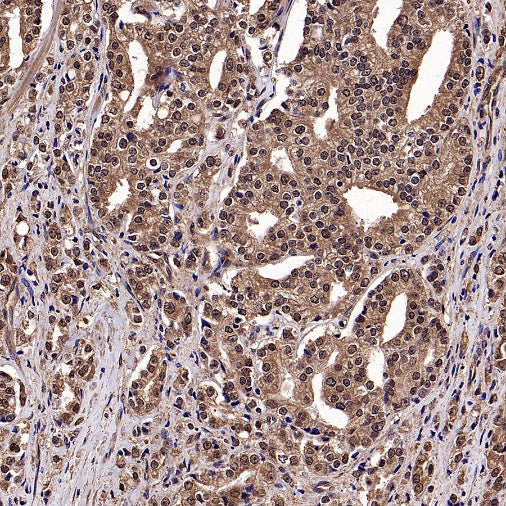 LMPTP Rabbit Polyclonal Antibody