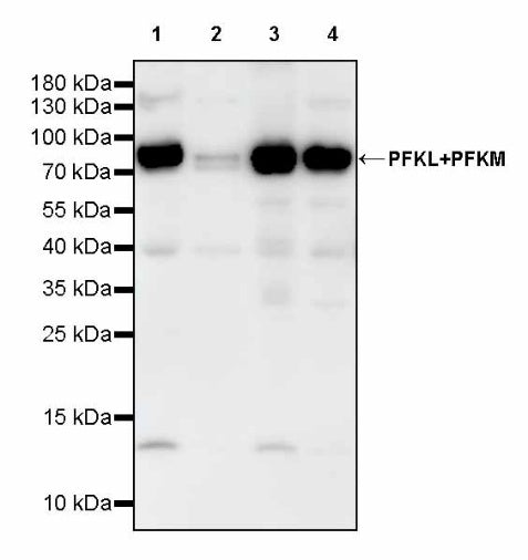 PFKL+PFKM Recombinant Rabbit mAb (S-1302-31)