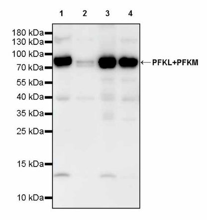 PFKL+PFKM Recombinant Rabbit mAb (S-1302-31)