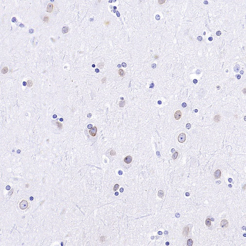 RanBP2 Recombinant Rabbit mAb (S-2593-310)