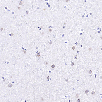 RanBP2 Recombinant Rabbit mAb (S-2593-310)