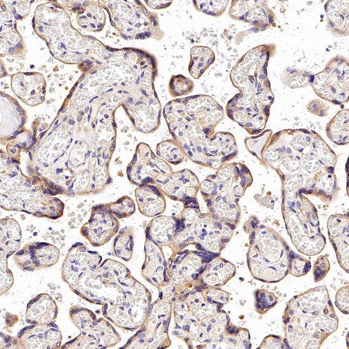 Rab5 Recombinant Rabbit mAb (S-1506-128)