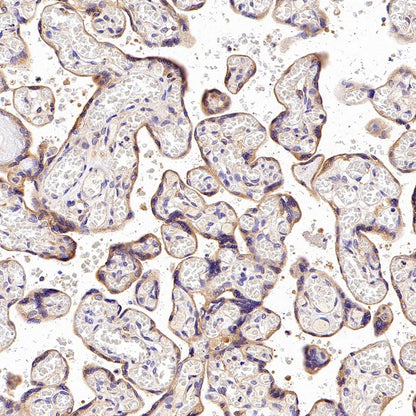 Rab5 Recombinant Rabbit mAb (S-1506-128)