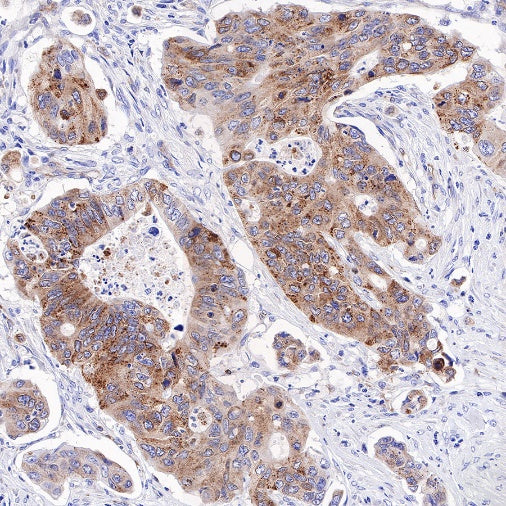 Amyloid Precursor Protein Recombinant Rabbit mAb (S-806-13)