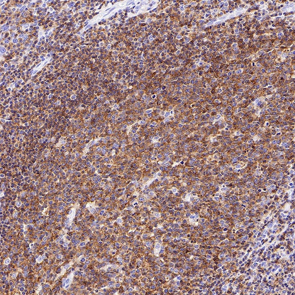 CD352/SLAM6 Recombinant Rabbit mAb (SDT-2472-77)