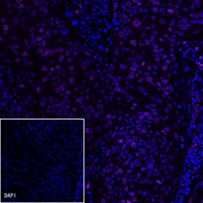 Ki67 Mouse mAb (Cy5 Conjugate) (S-606-33)