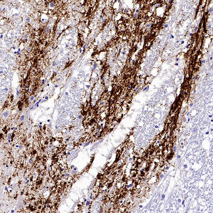 CGRP Recombinant Rabbit mAb (S-2490-74)