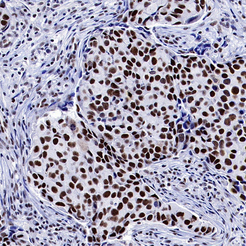 PPARγ Recombinant Rabbit mAb (SDT-556-108)