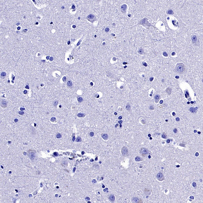 Uteroglobin Recombinant Rabbit mAb ,PBS Only(SDT-2736-46)