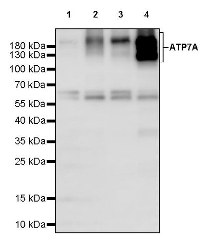 ATP7A Recombinant Rabbit mAb (S-2289-106)