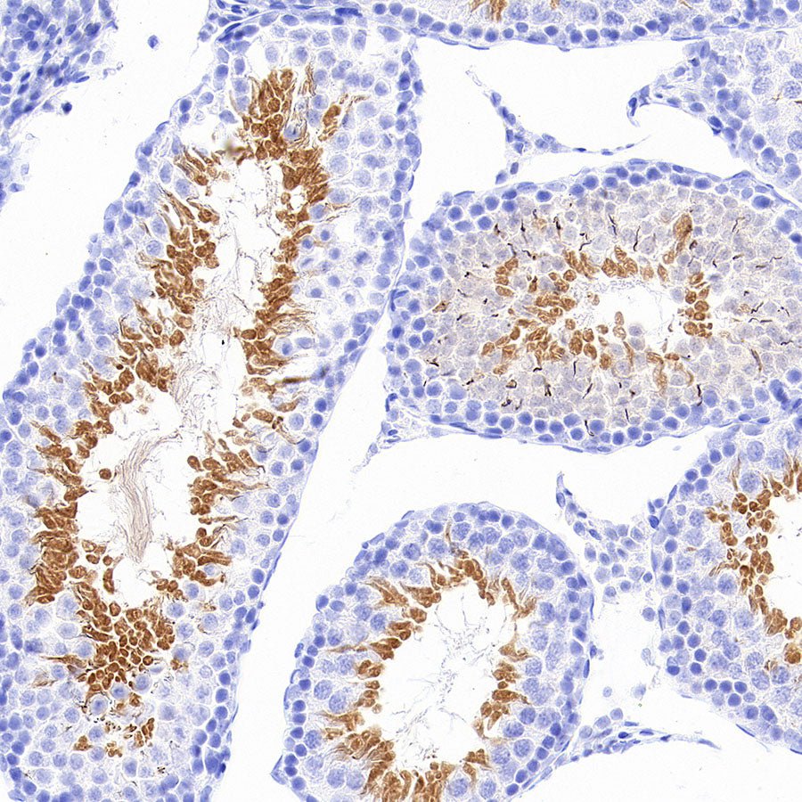 Stat4 Recombinant Rabbit mAb (S-4916-70)