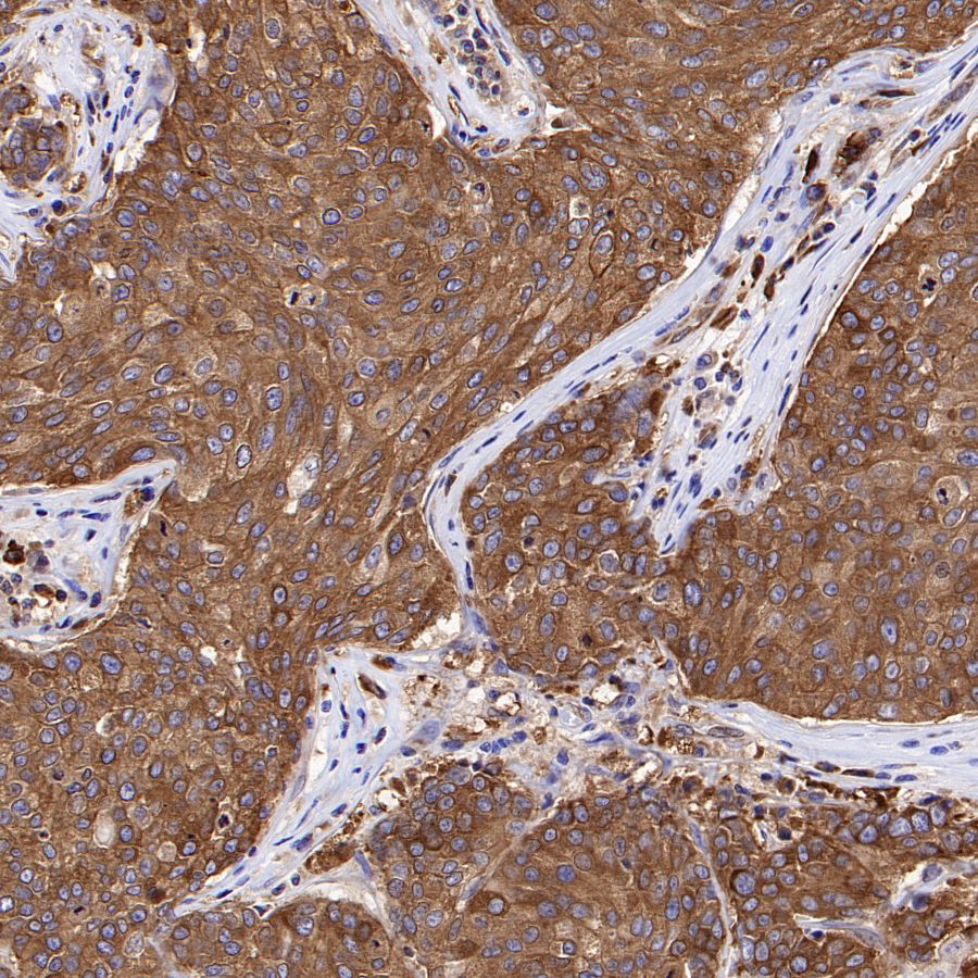 eEF2 Recombinant Rabbit mAb (S-1976-35)