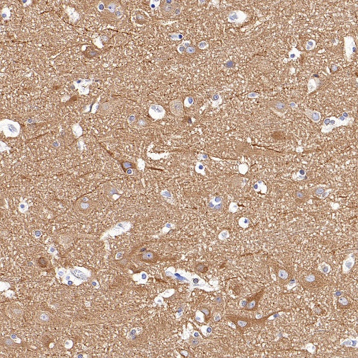 Beta IV Tubulin Recombinant Rabbit mAb (S-1572-30)
