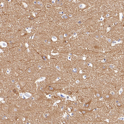 Beta IV Tubulin Recombinant Rabbit mAb (S-1572-30)