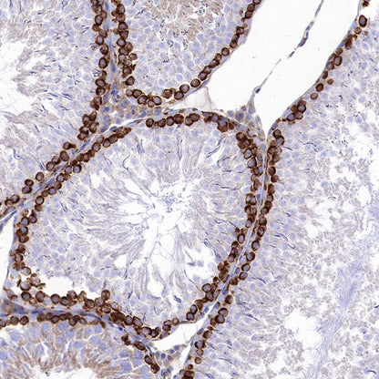 FMRP Recombinant Rabbit mAb (S-1671-1)
