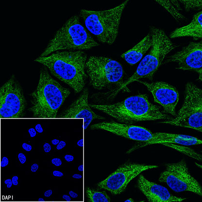 Alpha Tubulin Recombinant Mouse mAb (S-5704)