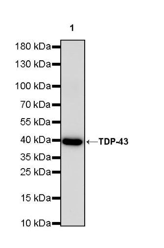 TDP-43 Recombinant Rabbit mAb (S-989-41)